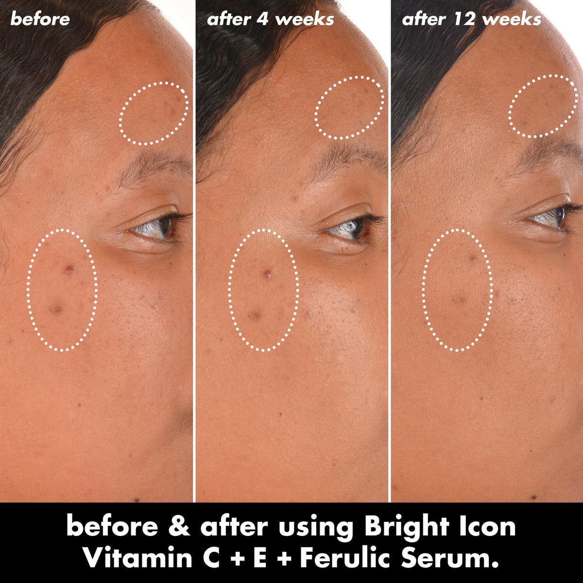 Bright Icon Vitamin C + E + Ferulic Serum