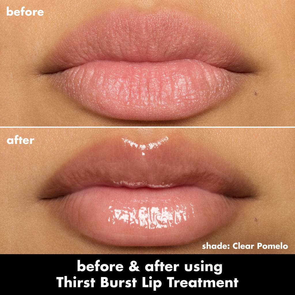 Thirst Burst Lip Treatment